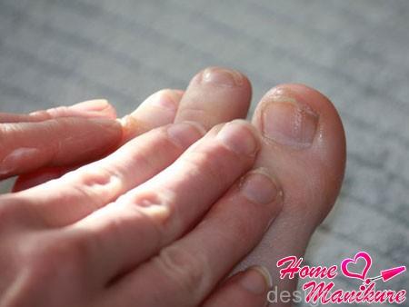 Размягчение ногтей на пальцах ног в домашних условиях